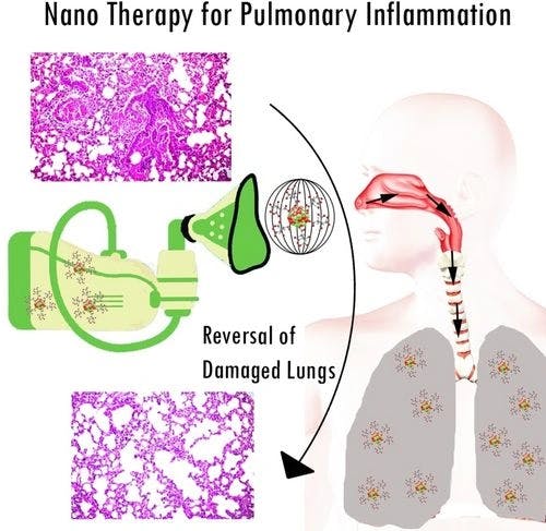 Targeted Redox Balancing through Pulmonary Nanomedicine Delivery Reverses Oxidative Stress Induced Lung Inflammation